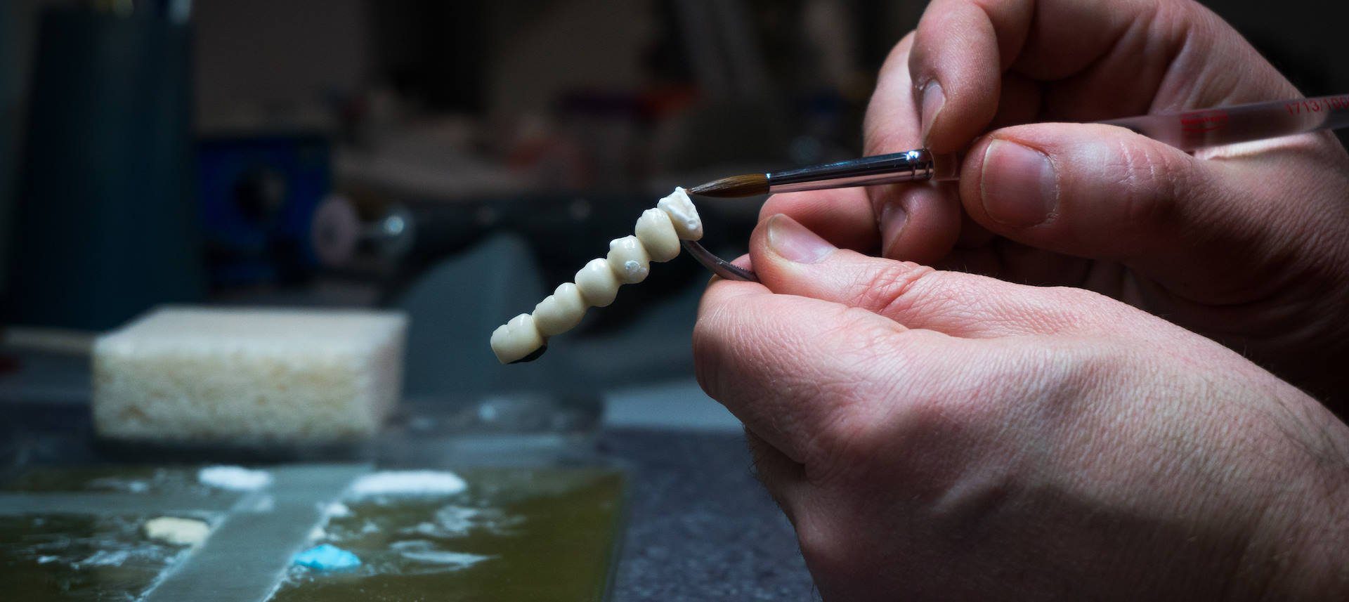 Restorative Dentistry Services Crowns, Bridges, Implants & Fillings