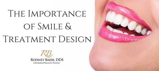 The importance of your smile treatment design