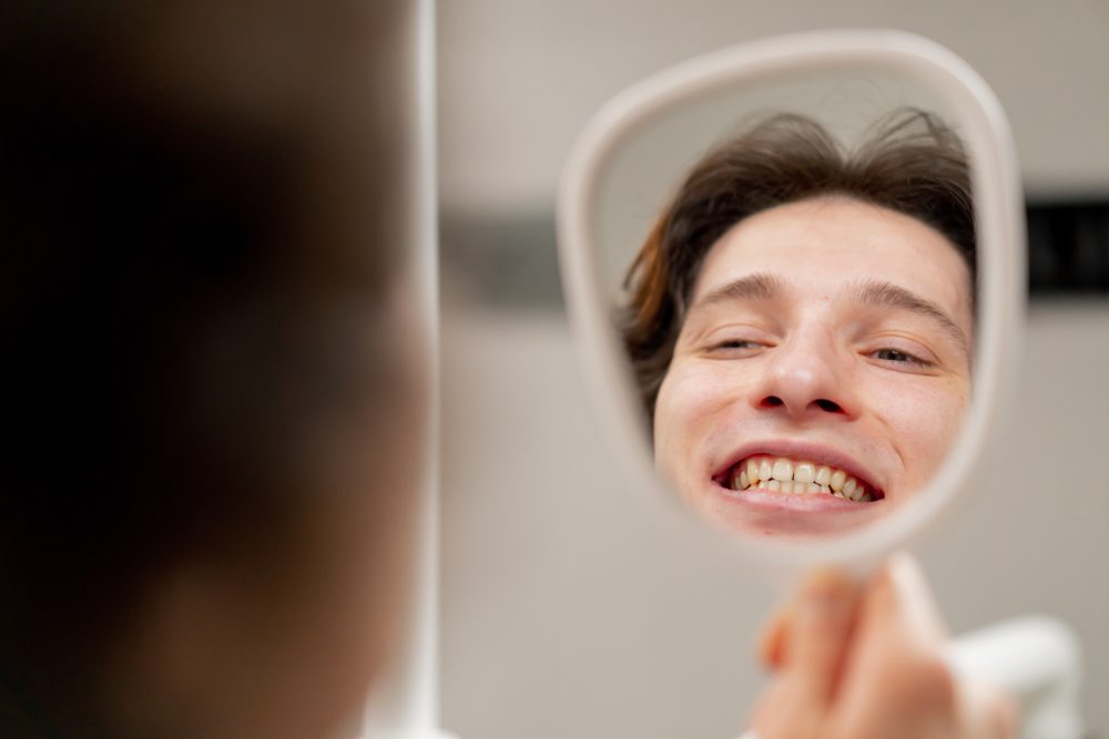Yellow teeth discoloration cosmetic dentistry