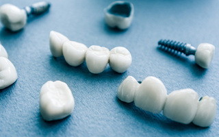 Restorative Dentistry at Rodney Baier, DDS in Sandy Springs